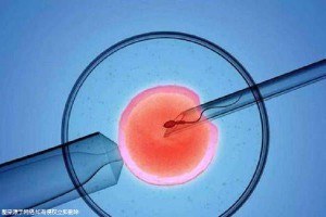 爱心同性供卵代孕微信群